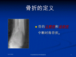 常见骨折的诊疗和类病鉴别课件.ppt