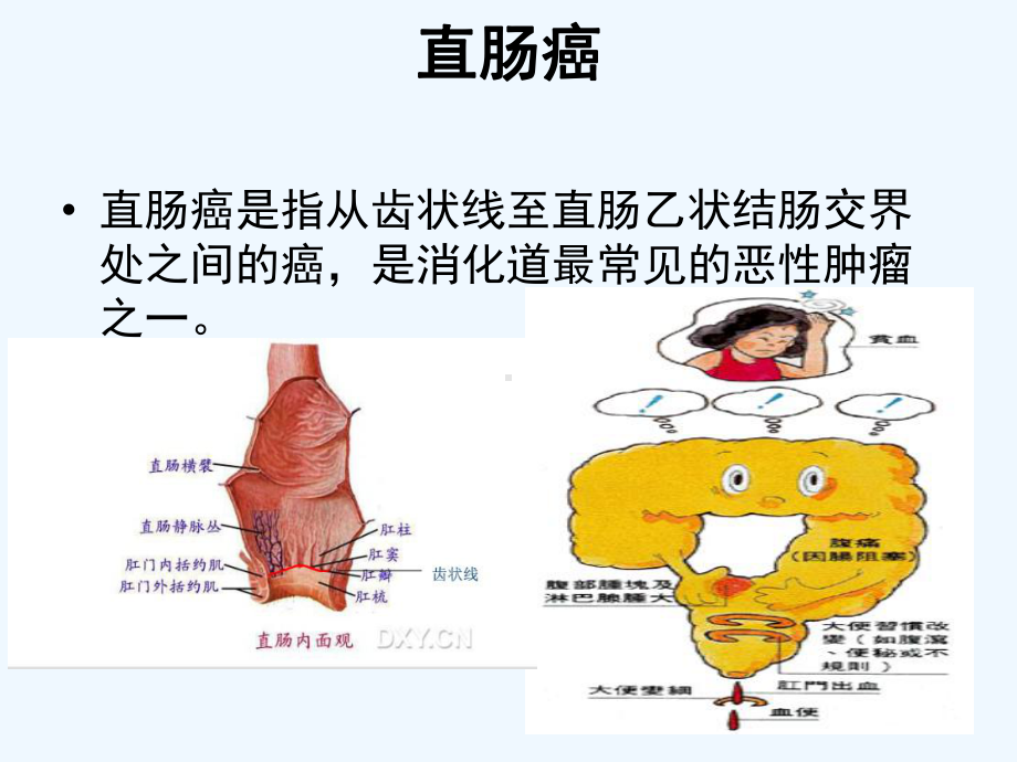 教学查房直肠癌围手术期护理介绍课件.ppt_第3页