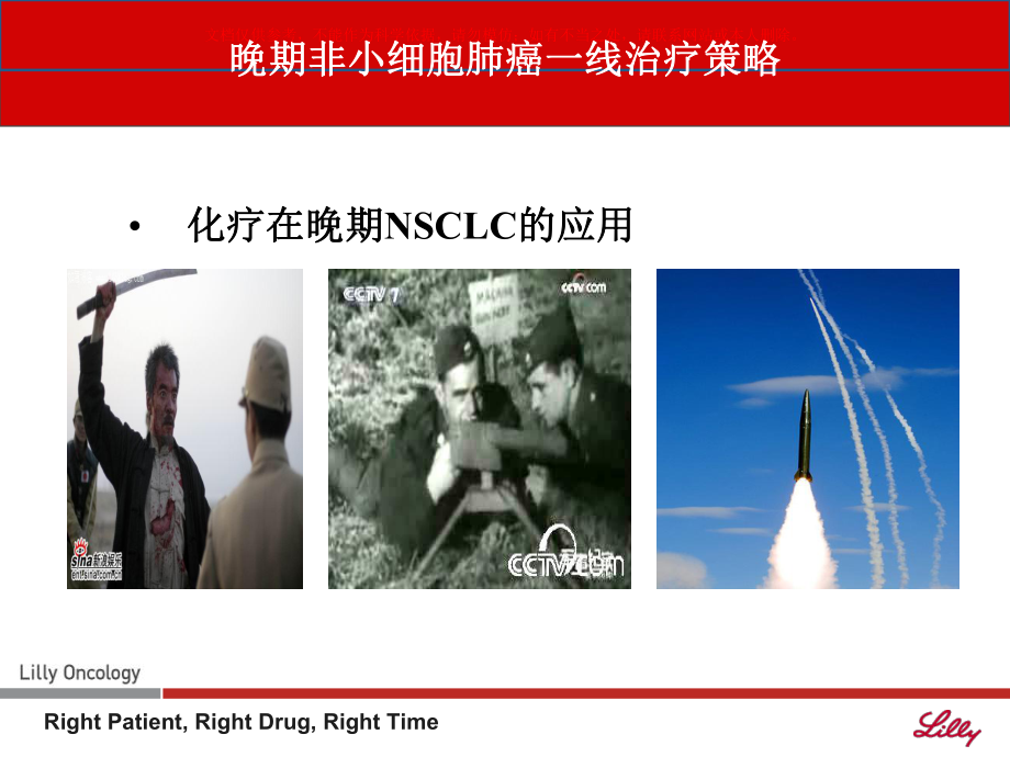 晚期非小细胞肺癌的一线治疗策略课件.ppt_第3页