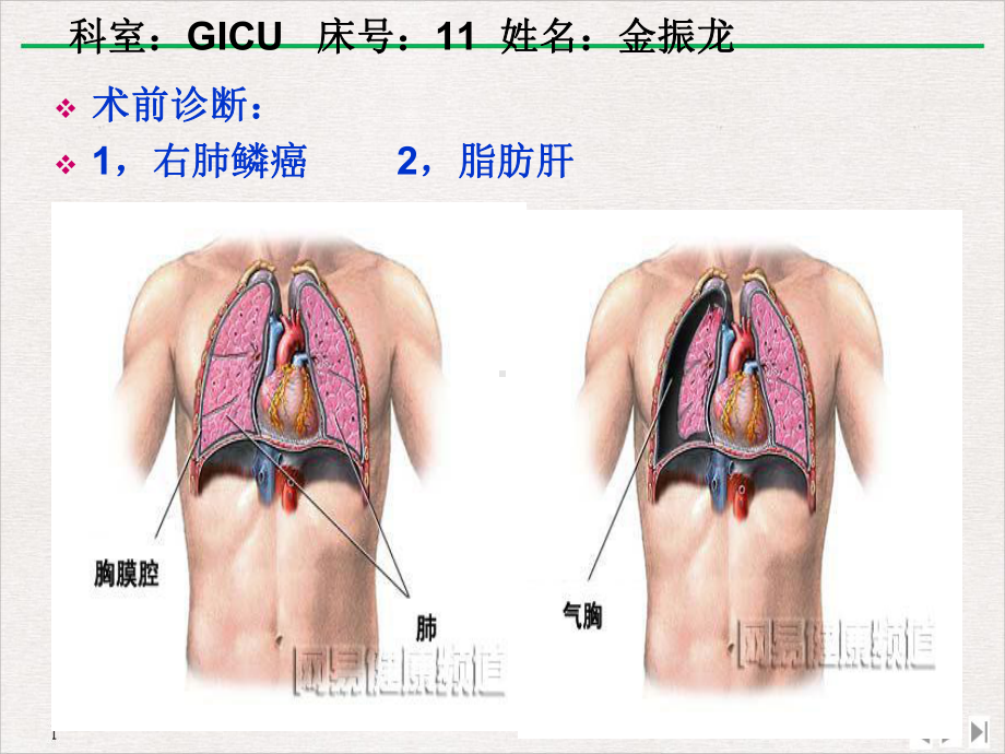 护理查房GICU标准课件.pptx_第2页