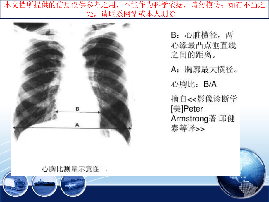 常见心脏病变的X线诊断培训课件.ppt_第3页