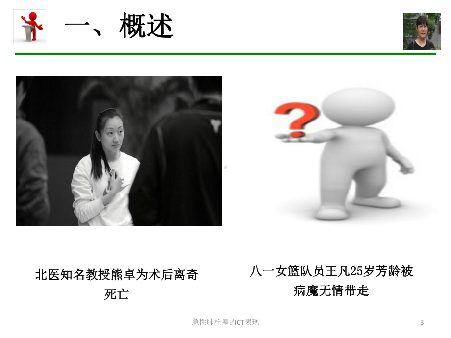 急性肺栓塞的CT表现培训课件.ppt_第3页