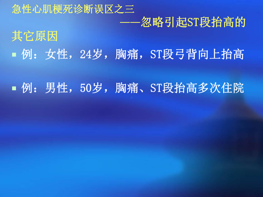 急性心肌梗死诊断治疗中的常见误区课件.pptx_第3页