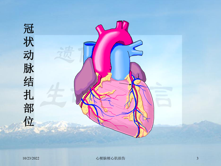 心梗脑梗心肌损伤培训课件.ppt_第3页