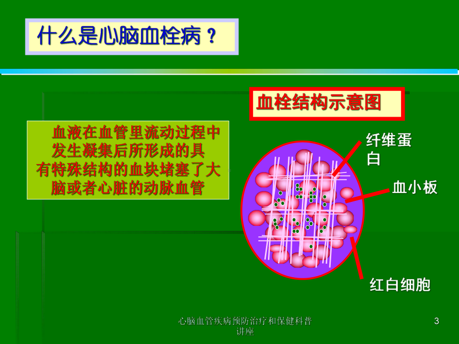 心脑血管疾病预防治疗和保健科普讲座培训课件.ppt_第3页