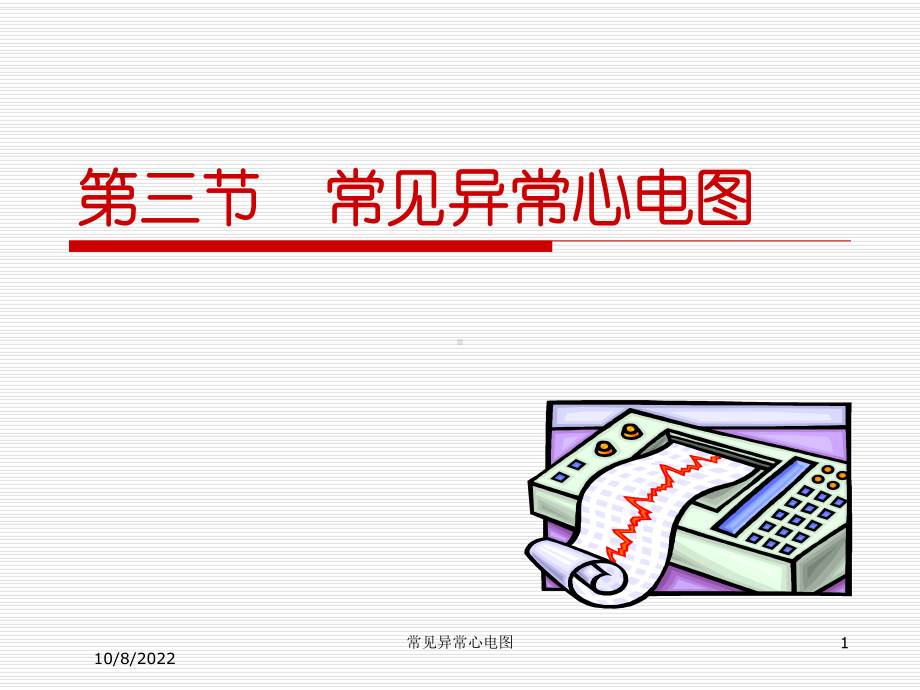 常见异常心电图培训课件.ppt_第1页