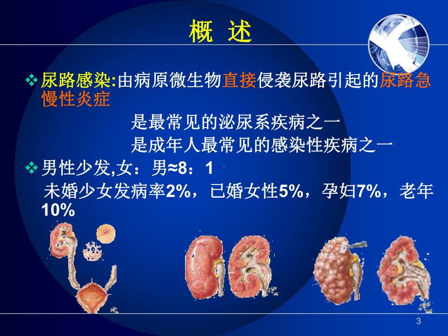 尿路感染护理知识课件.ppt_第3页