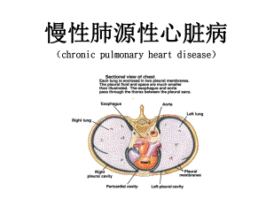 慢性肺源性心脏病(护理)课件.ppt