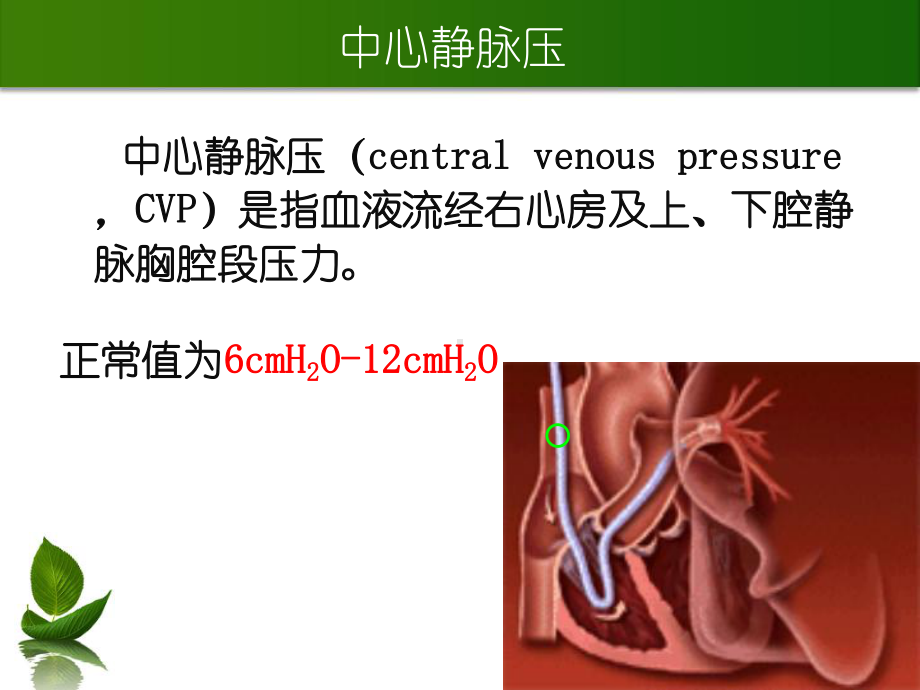 心静脉压测定与中心静脉导管护理课件.ppt_第3页