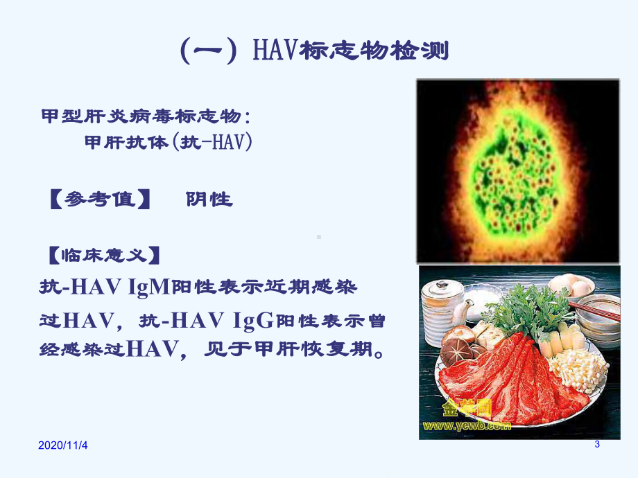 感染免疫肿瘤标志物检查课件.ppt_第3页