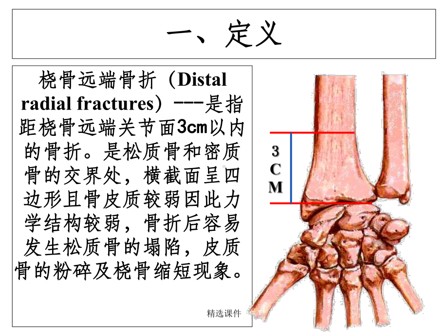 桡骨远端骨折教学查房课件-2.ppt_第2页