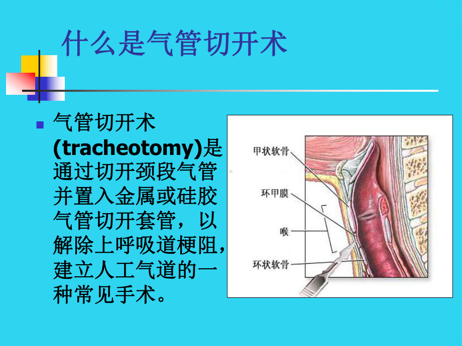 教学培训-气管切开的护理课件.ppt_第3页