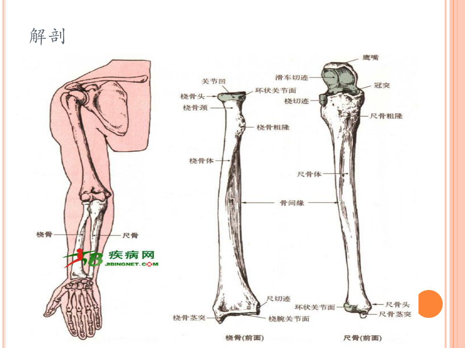 尺桡骨骨折的护理主题讲座课件.ppt_第2页