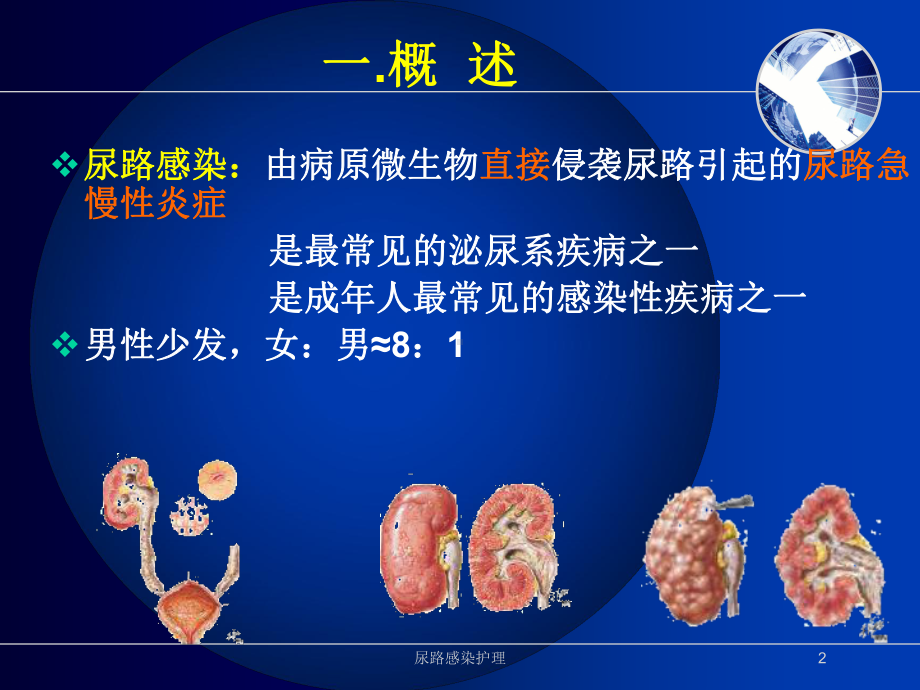 尿路感染护理培训课件.ppt_第2页