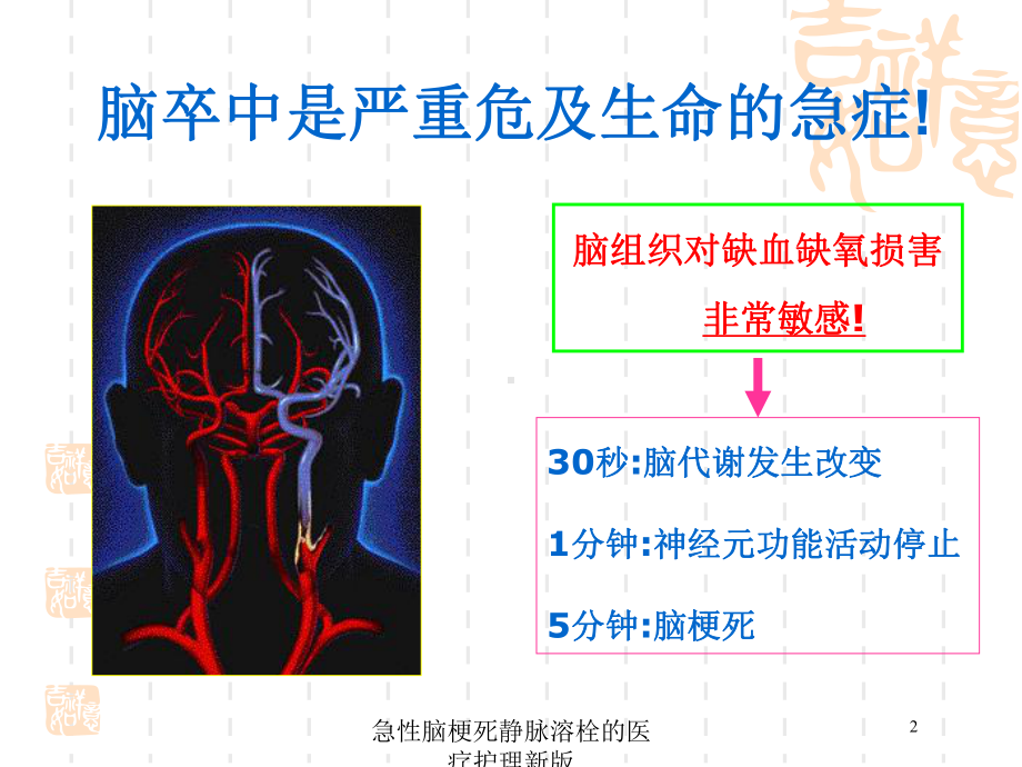 急性脑梗死静脉溶栓的医疗护理新版培训课件.ppt_第2页