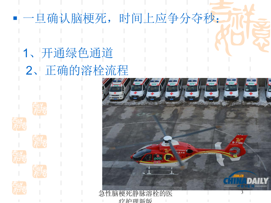 急性脑梗死静脉溶栓的医疗护理新版培训课件.ppt_第3页