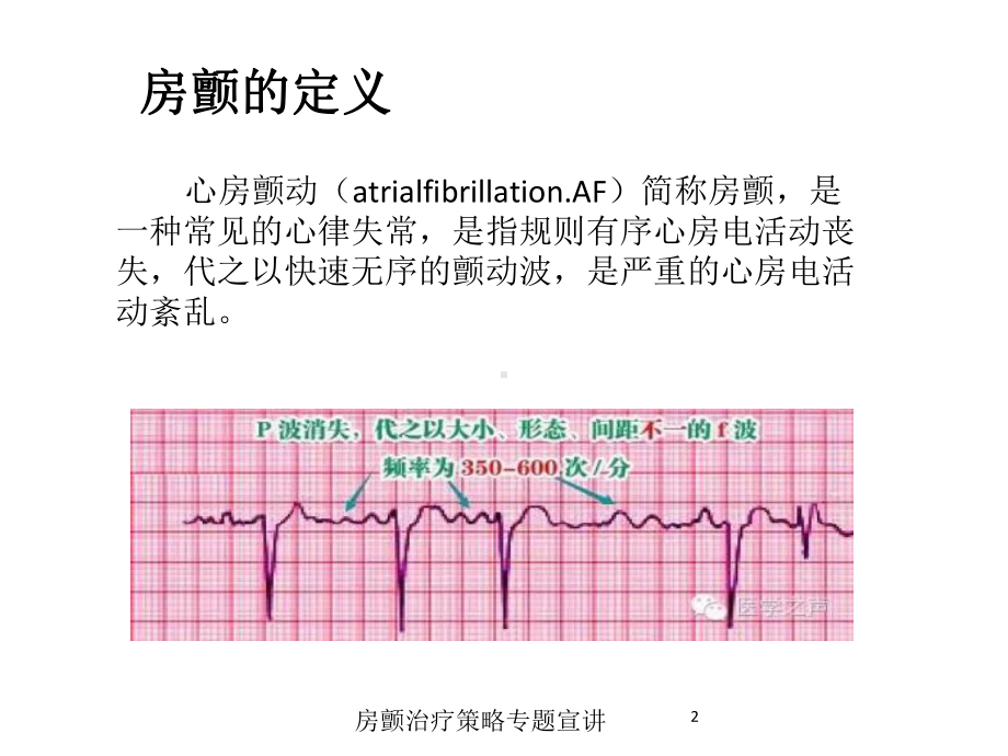 房颤治疗策略专题宣讲培训课件.ppt_第2页