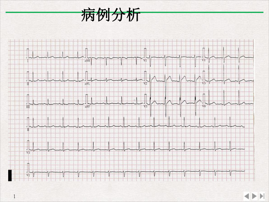 急性胸痛诊治流程课件-2.ppt_第3页