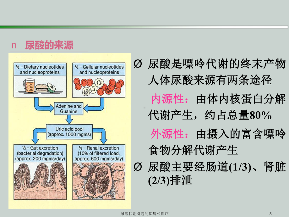 尿酸代谢引起的疾病和治疗培训课件.ppt_第3页