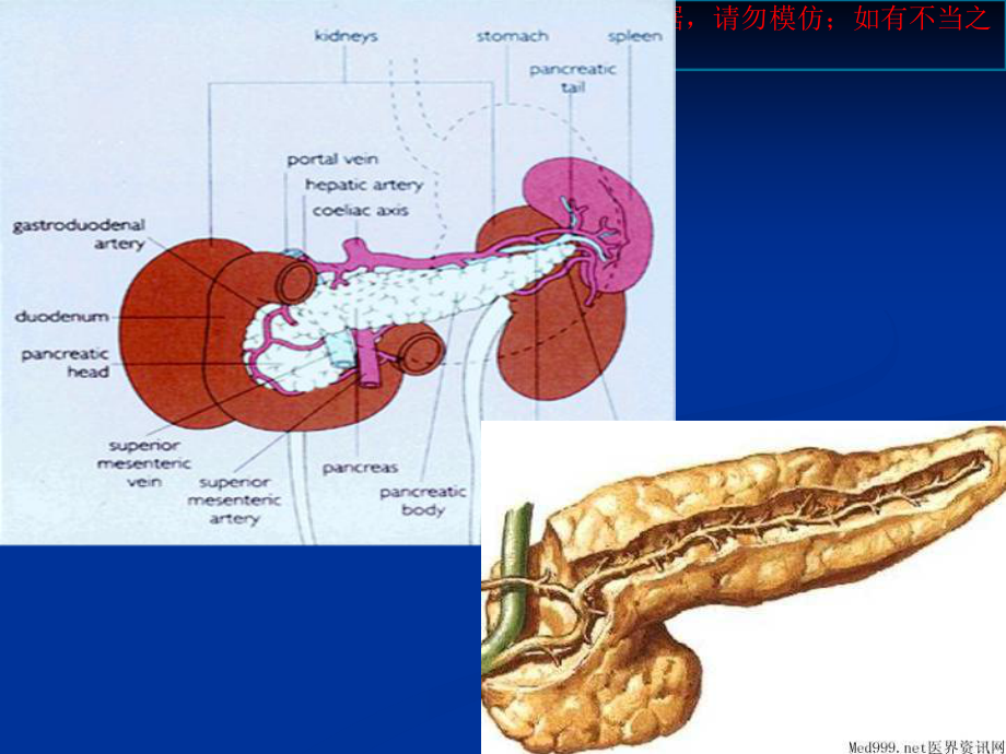 急性胰腺炎讲解宣讲培训课件.ppt_第1页