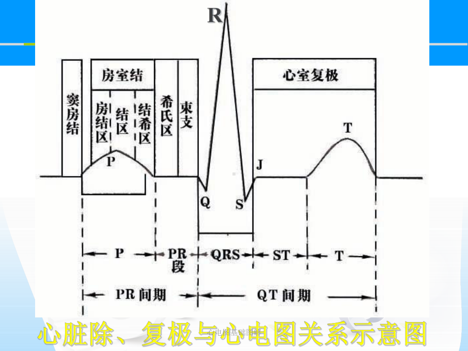 心电图基础图解培训课件.ppt_第3页