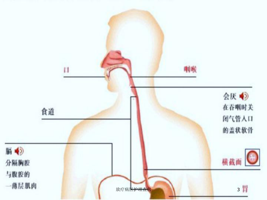 放疗病区护理查房培训课件.ppt_第3页