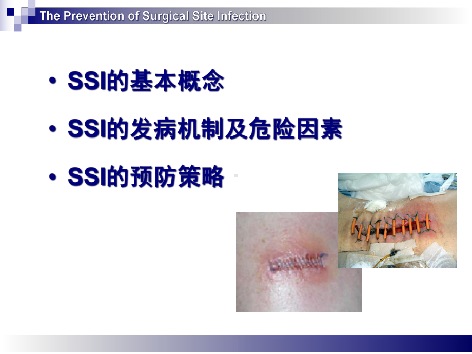 手术部位感染预防和控制培训课件-2.ppt_第2页