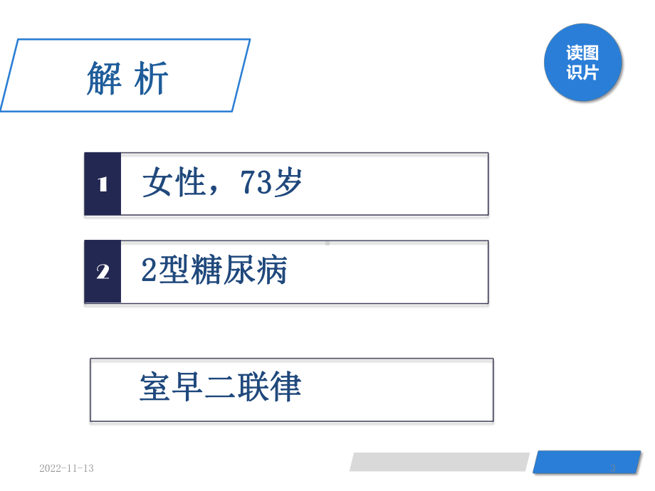 心电图(室性早搏)参考课件.ppt_第3页