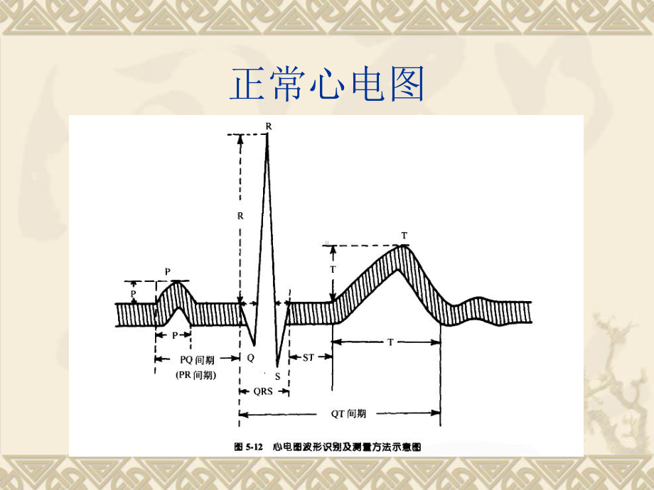 常见心律失常的诊断和处理综述课件.ppt_第2页