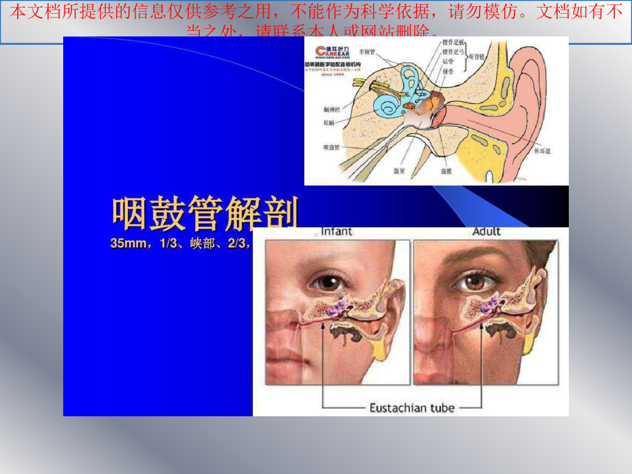 急性化脓性中耳炎汇总培训课件.ppt_第2页