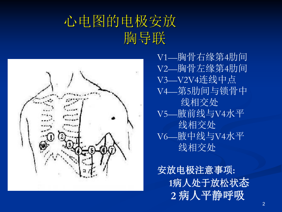 心律失常分析培训课件.ppt_第2页