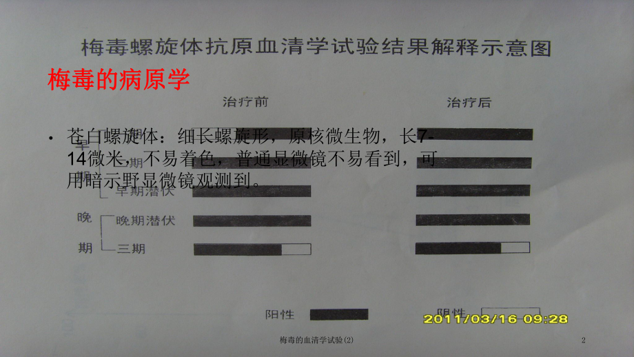 梅毒的血清学试验课件2.ppt_第2页