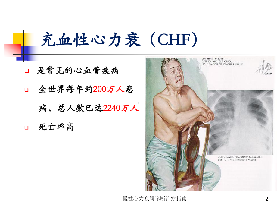 慢性心力衰竭诊断治疗指南培训课件.ppt_第2页