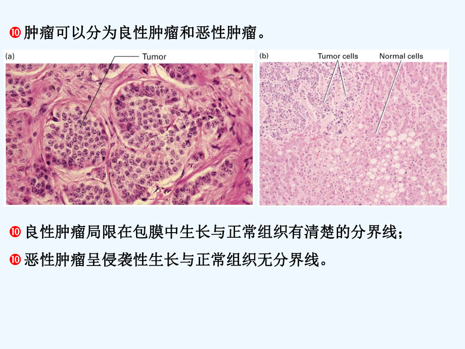 常见肿瘤的防治课件.ppt_第3页