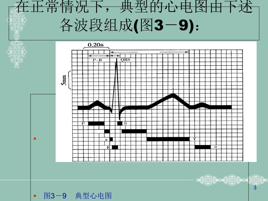 心肌细胞动作电位与心电图的关系医学课件.ppt_第3页