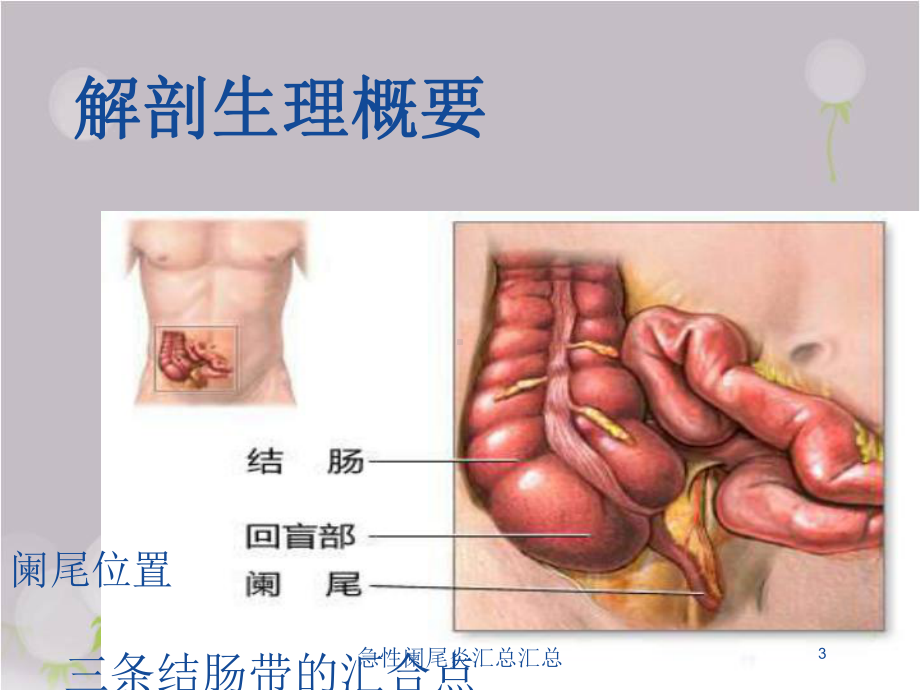 急性阑尾炎汇总汇总培训课件.ppt_第3页