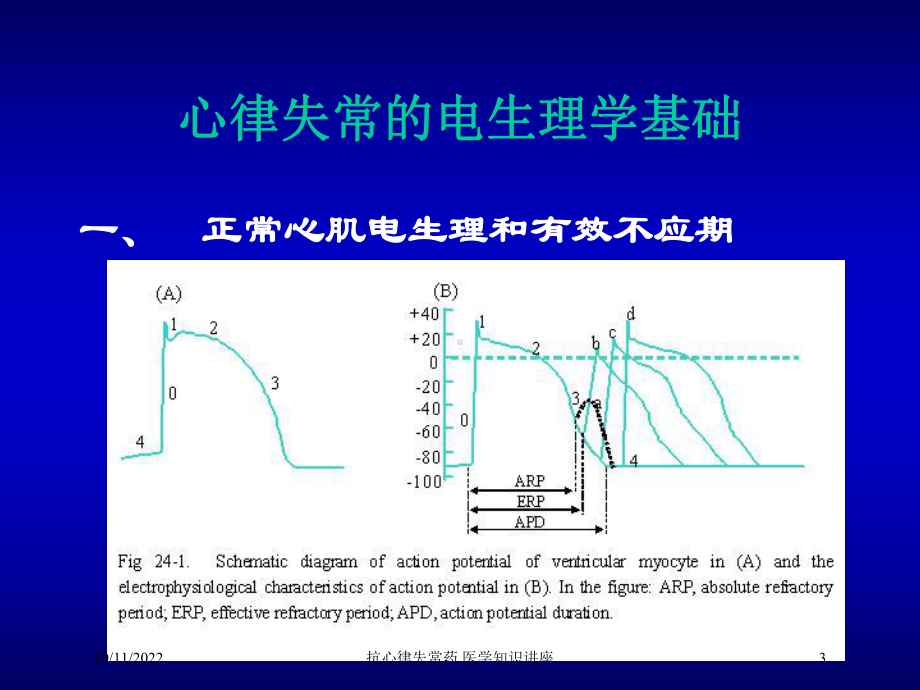 抗心律失常药-医学知识讲座培训课件.ppt_第3页