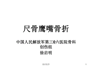 尺骨鹰嘴骨折(行业运用)课件.ppt