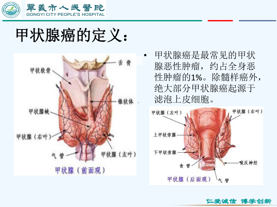 甲状腺癌教学查房胸心外科课件.ppt_第2页