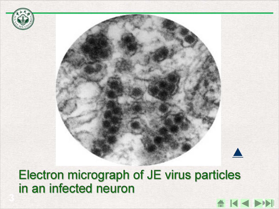 流行性乙型脑炎DZD精选课件.pptx_第3页
