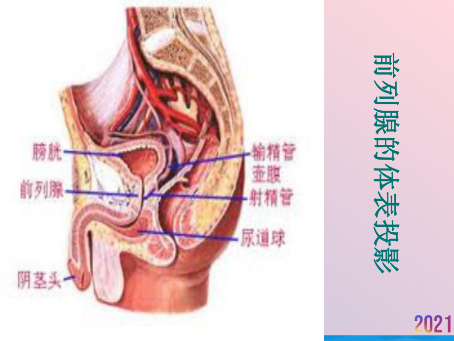 电切综合征课件.ppt_第3页