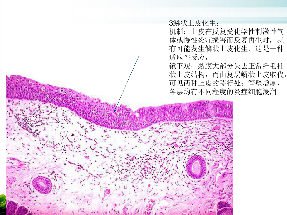 病理实验考试新课件.ppt_第3页