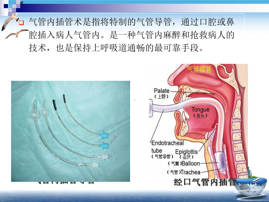 气管内插管术—外科学课件.pptx_第1页