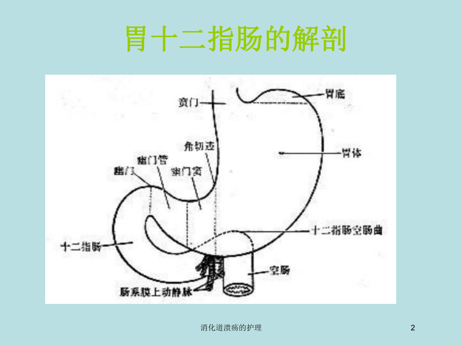 消化道溃疡的护理培训课件.ppt_第2页