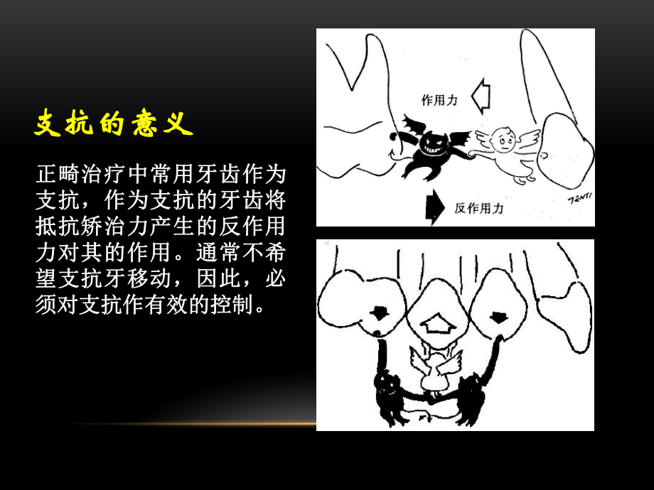 正畸治疗中的支抗控制课件.ppt_第3页