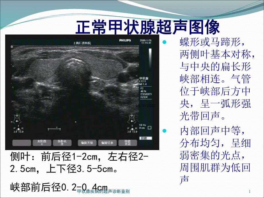 甲状腺疾病的超声诊断鉴别培训课件.ppt_第1页