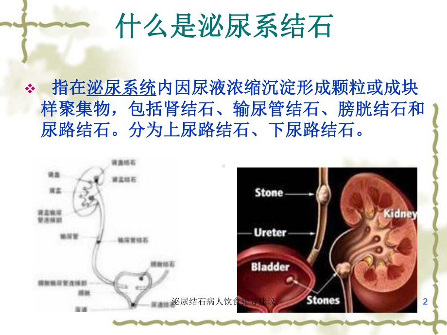 泌尿结石病人饮食指导建议培训课件.ppt_第2页