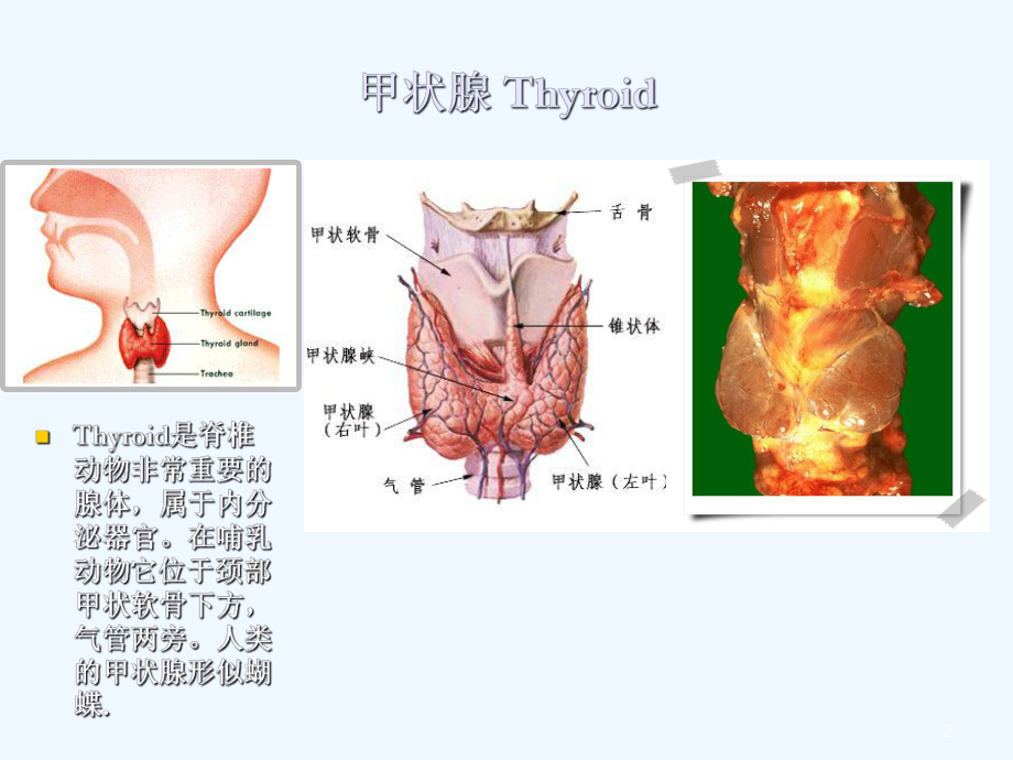 甲状腺激素药课程课件.ppt_第2页