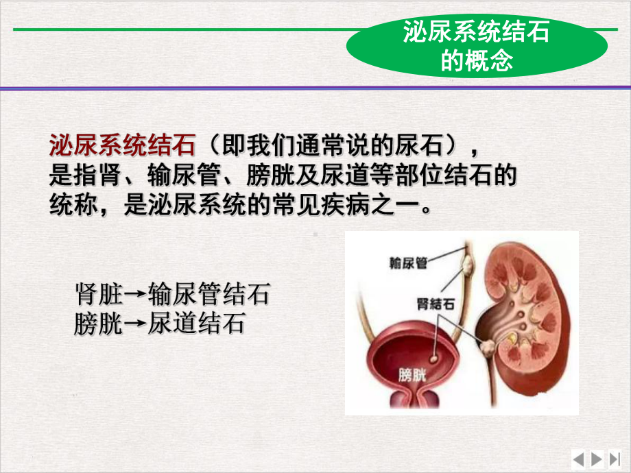 泌尿系统结石的防治实用版课件.pptx_第2页