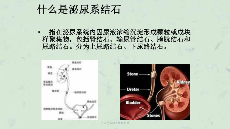 泌尿结石病人饮食指导课件.ppt_第3页